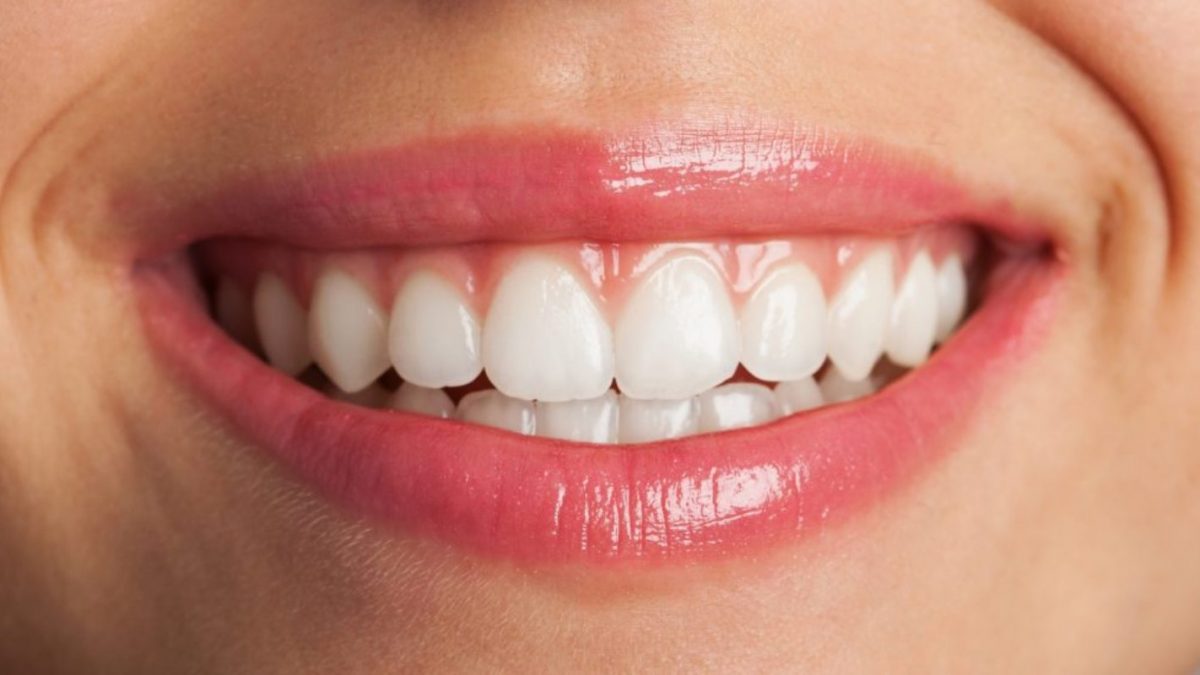 What Are The 9 Techniques To Maintain Your Teeth Healthy?